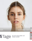 Vorher nachher Vergleich der Gesichtshaut über 14 Tage mit BoosterLab No 1337 Peptide Firming Serum von Bergamond & Birch die Haut wirkt glatter und fühlbar straffer