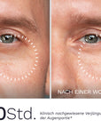 Männliche Augenpartie vor und nach einer Woche Anwendung der Bergamond & Birch Firming Eye Cream – sichtbare Glättung feiner Linien