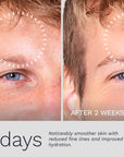 Before and after comparison showing visible skin improvements after 14 days of using Hydrate No. 23 Anti-Age Cream, with smoother skin and reduced fine lines.