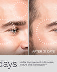 Close-up male face before and after 21 days of Bergamond & Birch Regenesis No. 36 Night Repair Cream, showing visibly improved firmness, smoother texture, and enhanced glow.