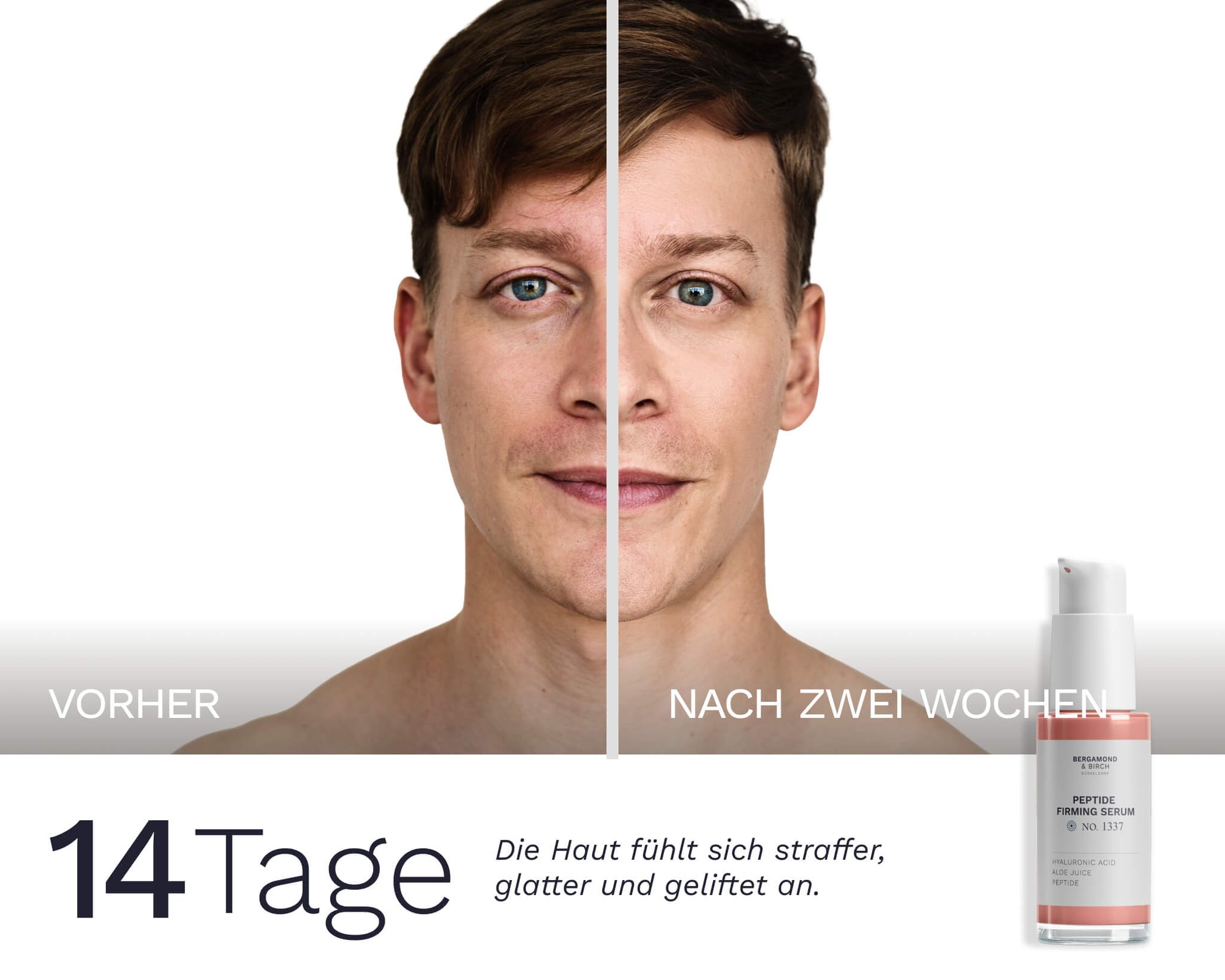 Vorher‑nachher Vergleich Gesicht eines Mannes nach 14 Tagen Anwendung des Bergamond & Birch Peptide Firming Serum – sichtbar straffer und glatter wirkende Haut.