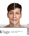 Ein Vorher Nachher Bild eines Mannes zeigt nach zwei Wochen Anwendung des Bergamond and Birch Peptide Firming Serum No 1337 ein glatter wirkendes und fühlbar strafferes Hautbild.
