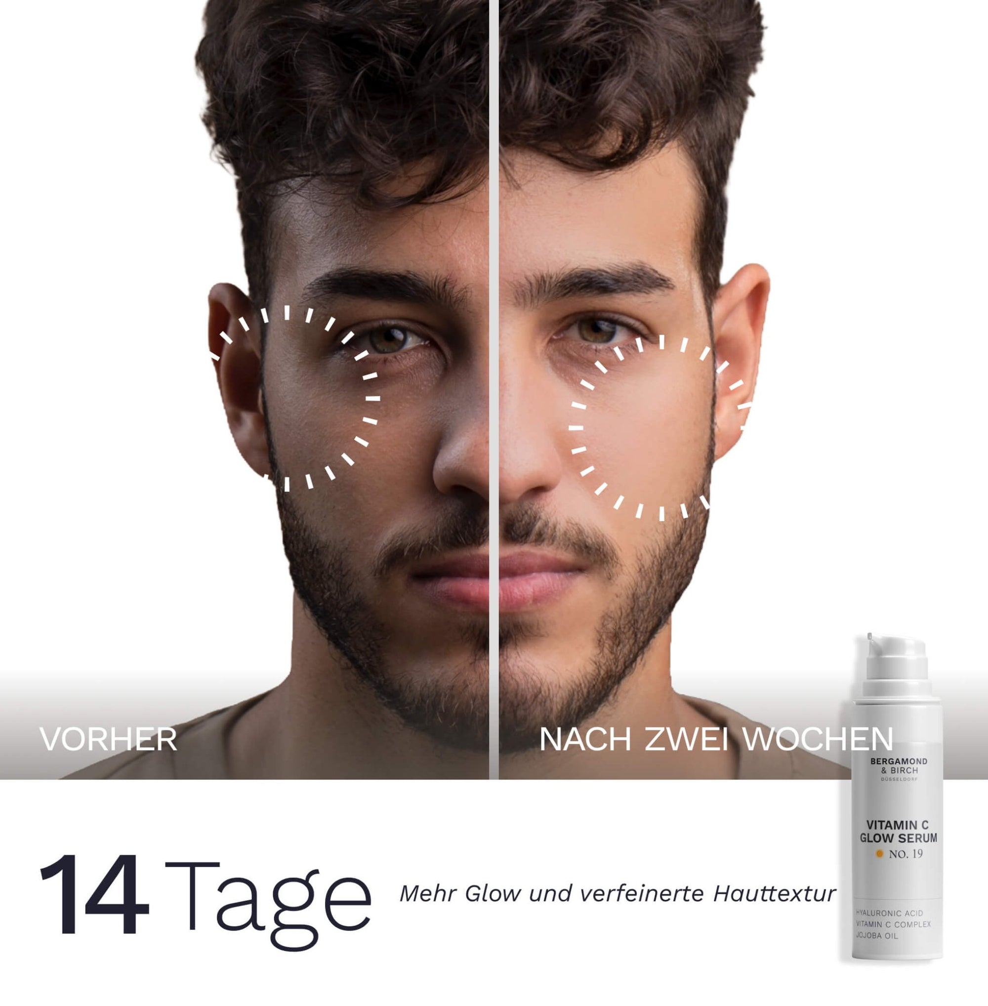 Das Bild zeigt einen Vorher Nachher Vergleich eines männlichen Gesichts nach 14 Tagen Anwendung des Bergamond and Birch Vitamin C Glow Serum No 19 mit Text Mehr Glow und verfeinerte Hauttextur.