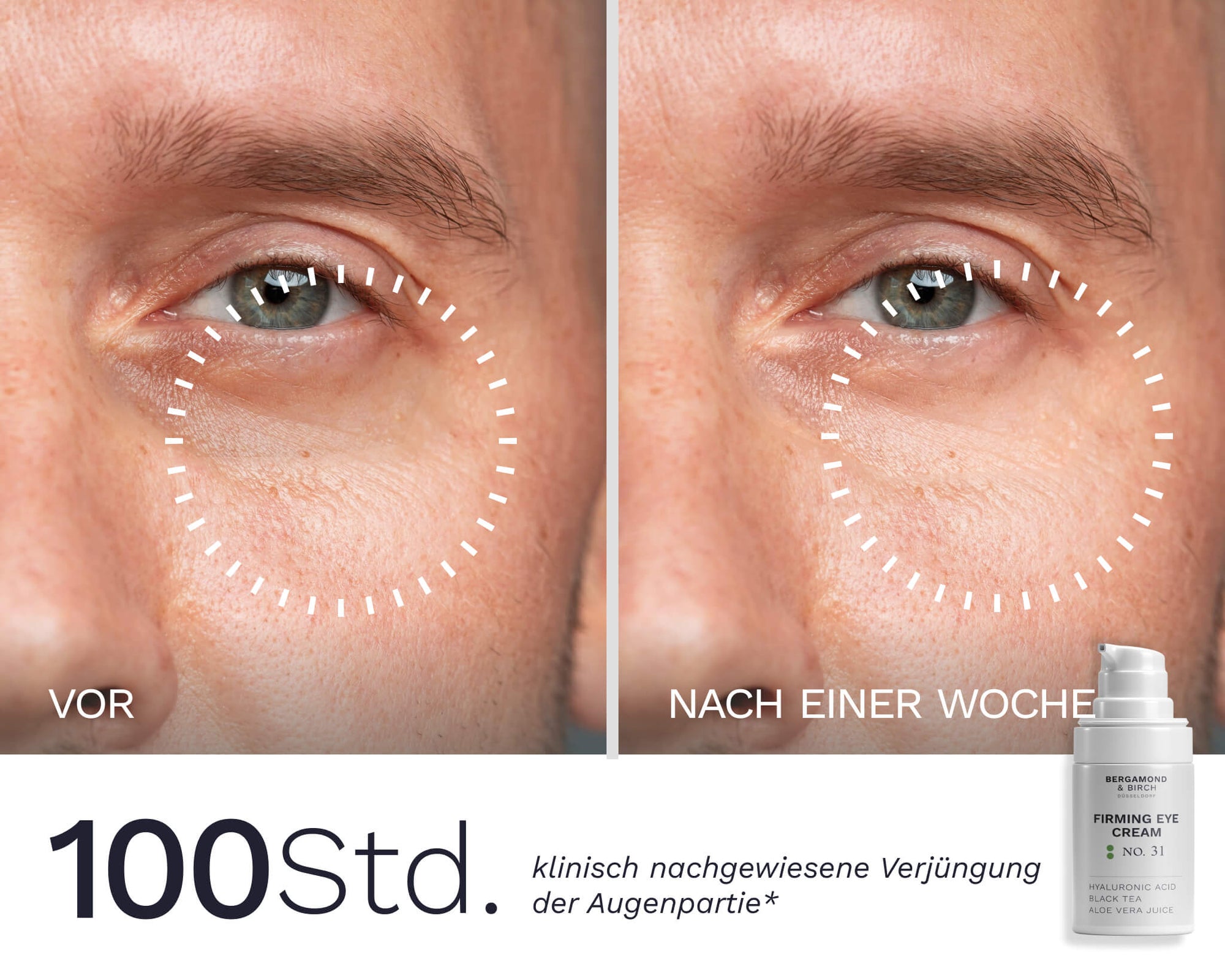 Männliche Augenpartie vor und nach einer Woche Anwendung der Bergamond & Birch Firming Eye Cream – sichtbare Glättung feiner Linien
