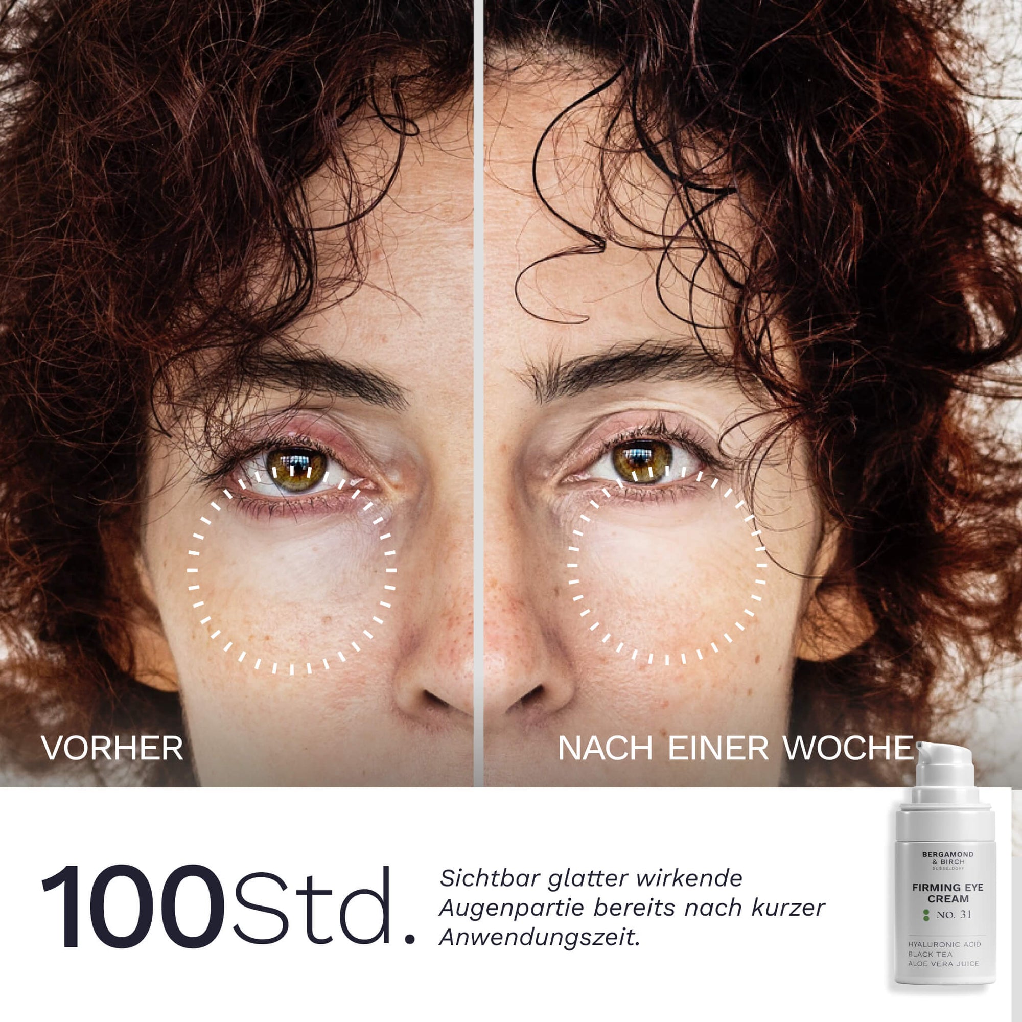 Vorher nachher Ergebnis mit Bergamond & Birch Firming Eye Cream No 31 sichtbare Reduktion von Fältchen und straffere Augenpartie bei natürlichem Licht