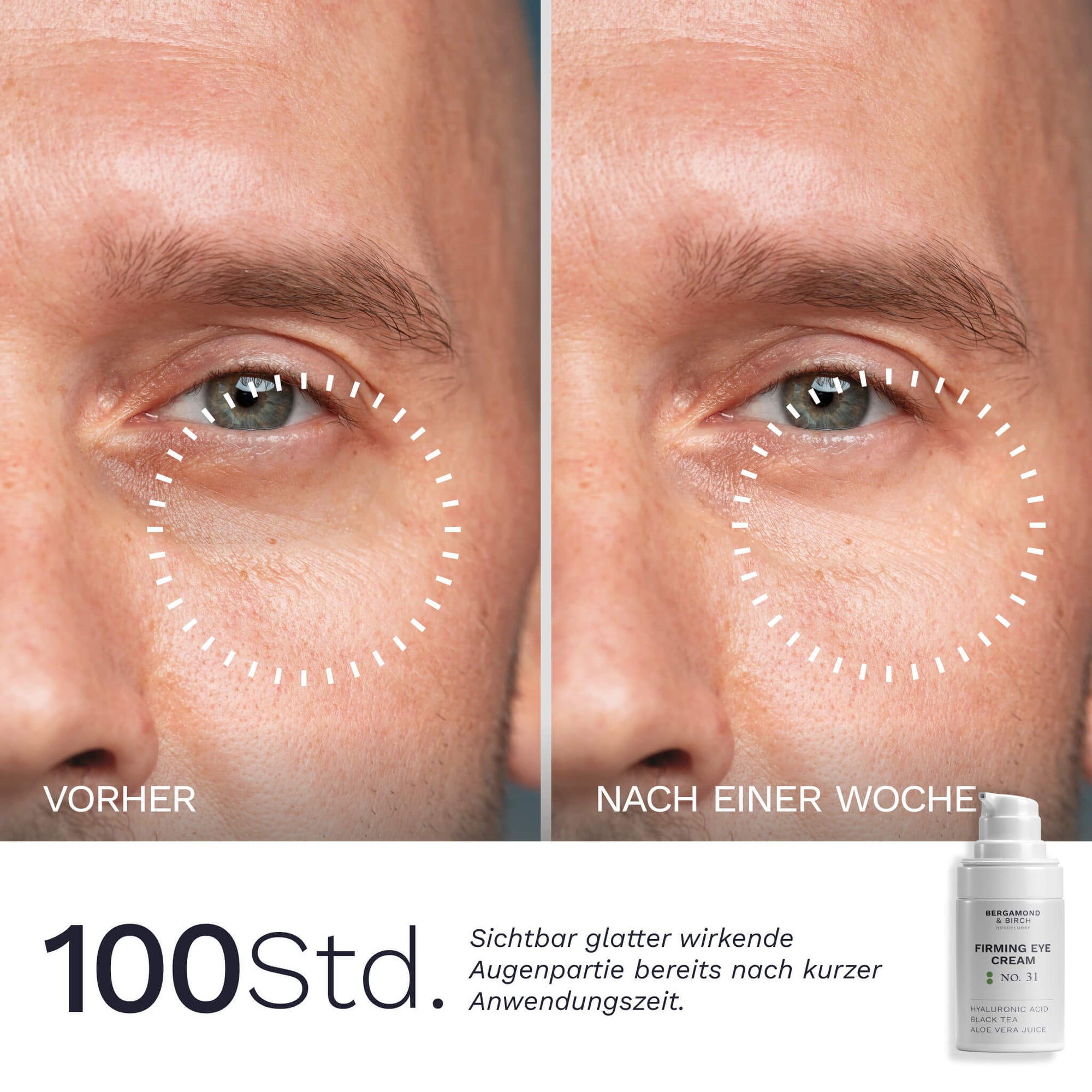 Eine cremige weiße Textur der Bergamond and Birch Firming Eye Cream No 31 liegt in einer Schale, ergänzt durch Text, der Aloe Vera Natrium PCA Rosskastanienextrakt Schwarztee und Dipalmitoyl Hydroxyprolin als pflegende Inhaltsstoffe erklärt.