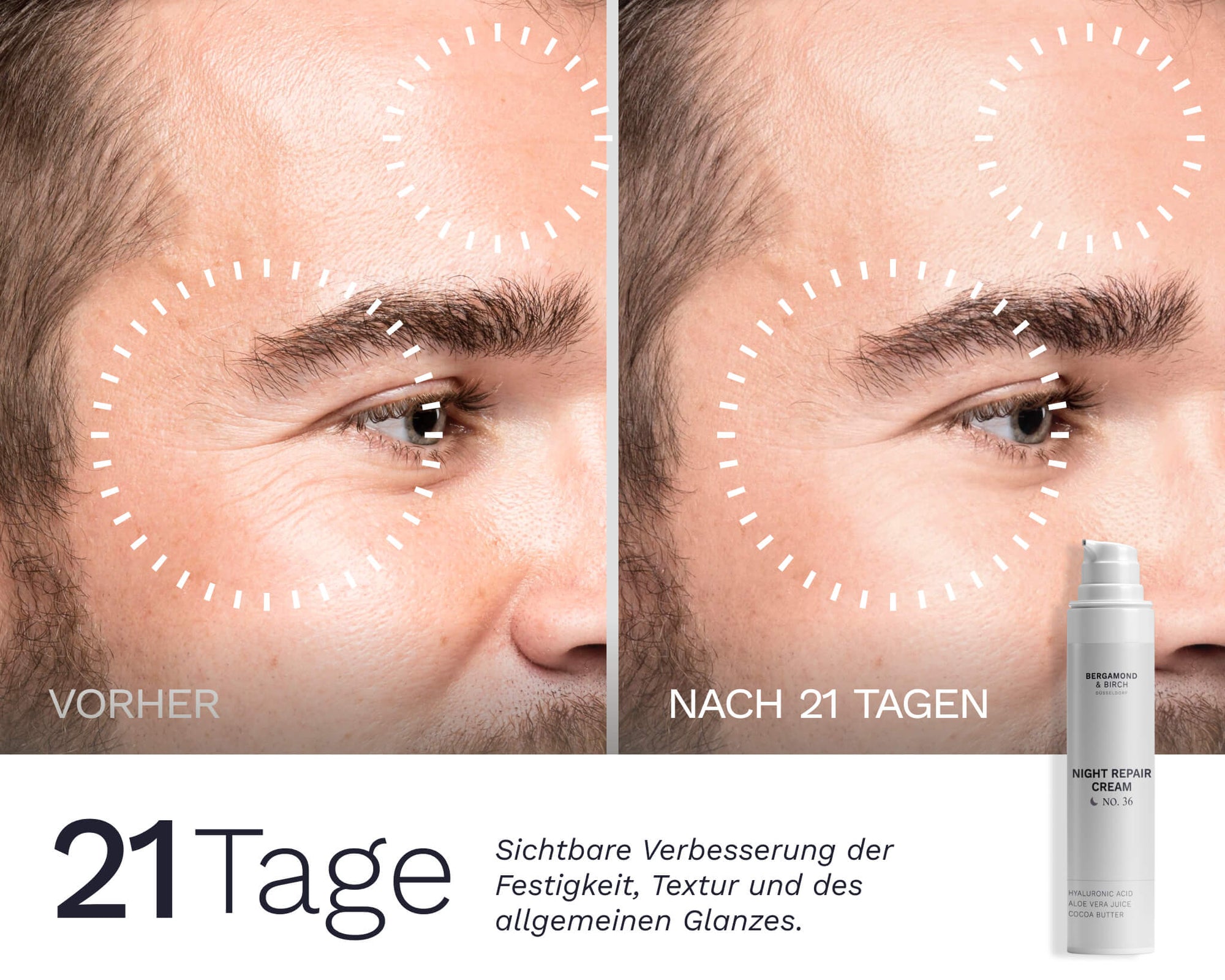 Vorher‑nachher Vergleich der Gesichtshaut eines Mannes nach 21 Tagen Anwendung der Bergamond & Birch Night Repair Cream – glattere, erholter wirkende Hautpartien.