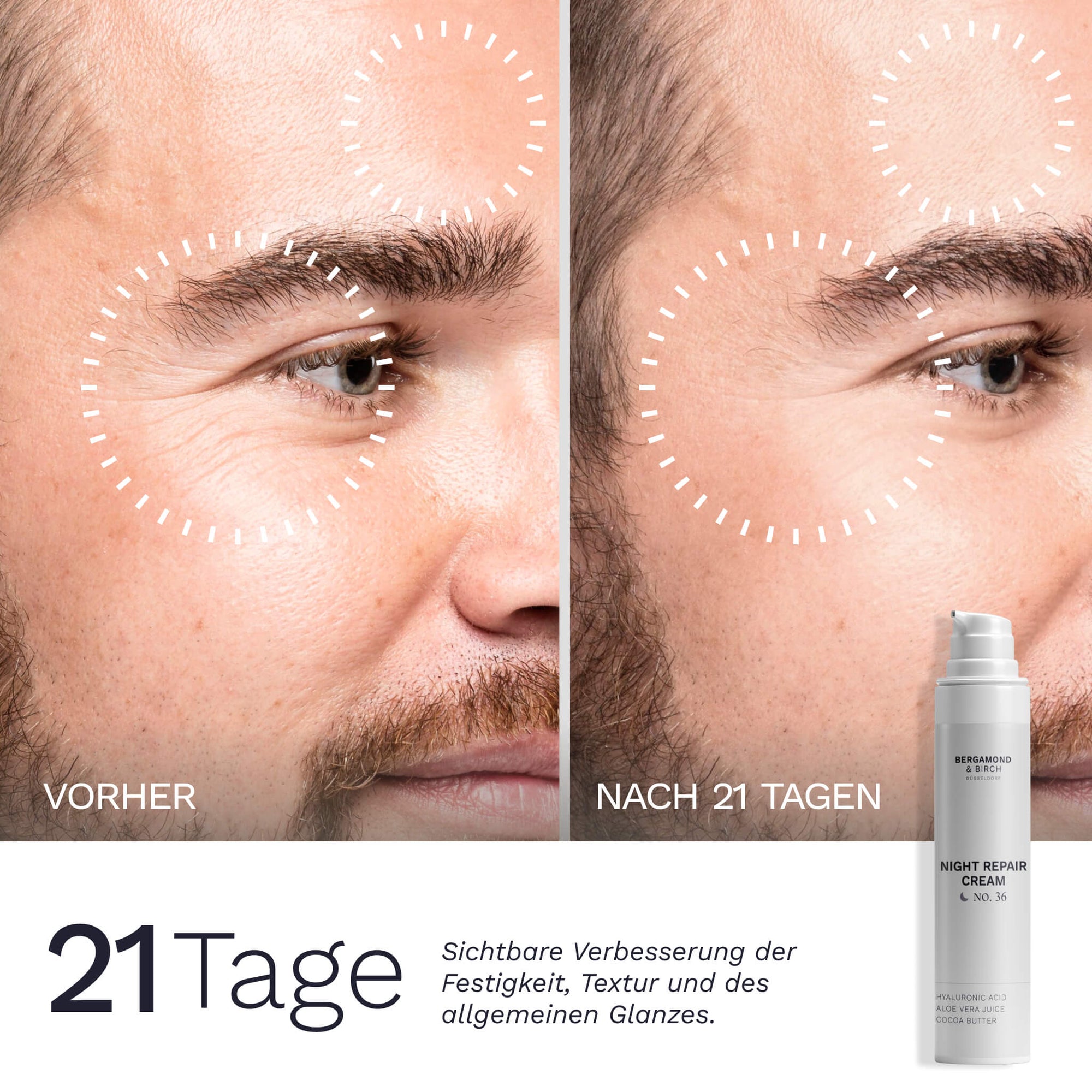Ein Vorher Nachher Bild der Stirn und Augenpartie eines Mannes zeigt nach 21 Tagen Anwendung der Bergamond and Birch Night Repair Cream No 36 eine glatter wirkende Haut mit verbesserter Festigkeit Textur und gesundem Glow.