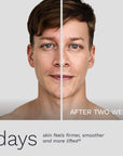 Split-face comparison of a man before and after 14 days using Bergamond & Birch BoosterLab Peptide Firming Serum, showing visibly firmer, smoother, and lifted skin.