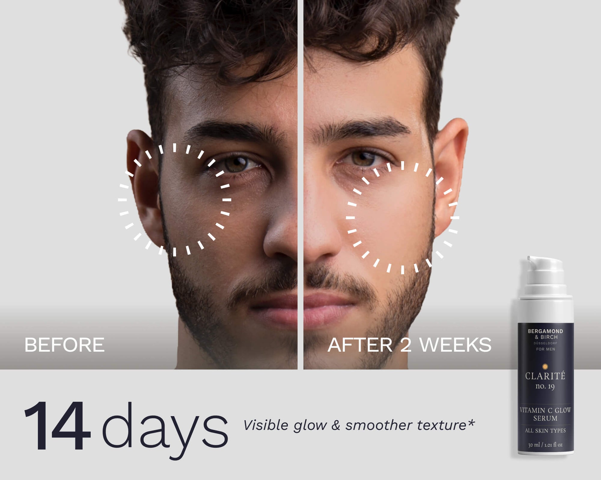 Before and after comparison showing visible glow and smoother skin texture after 14 days of Clarité No. 19 Serum use.