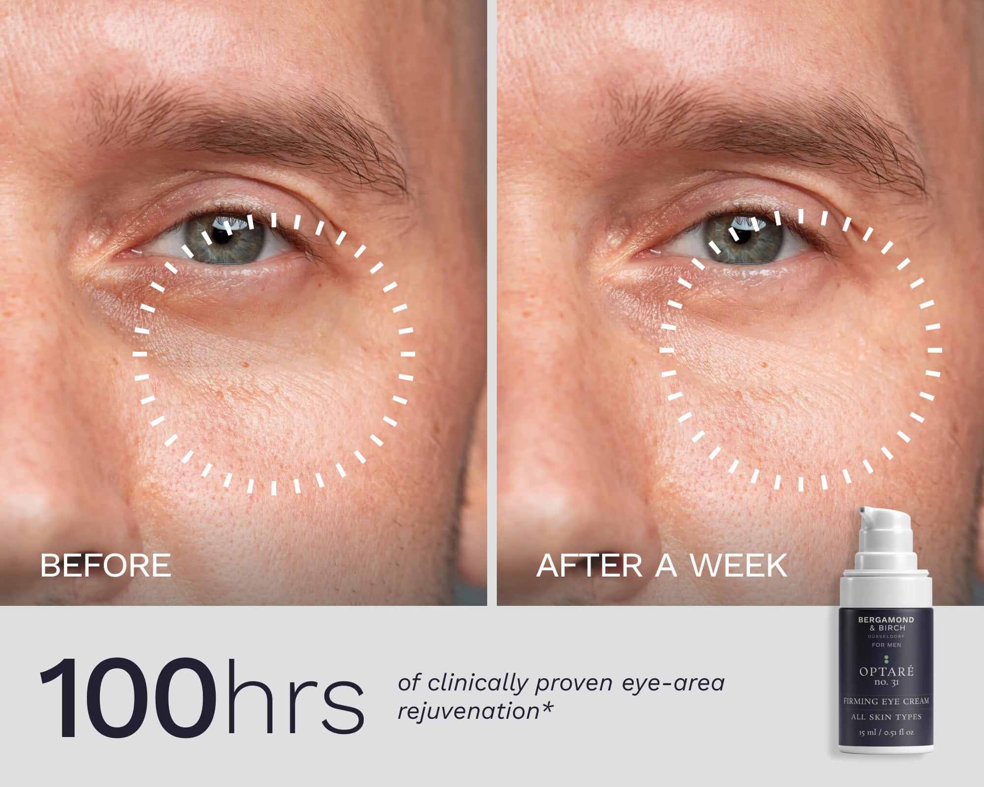 Close-up eye area before and after one week of Bergamond & Birch Optaré No. 31 Firming Eye Cream, showing reduced puffiness and smoother fine lines.