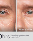 Close-up eye area before and after one week of Bergamond & Birch Optaré No. 31 Firming Eye Cream, showing reduced puffiness and smoother fine lines.