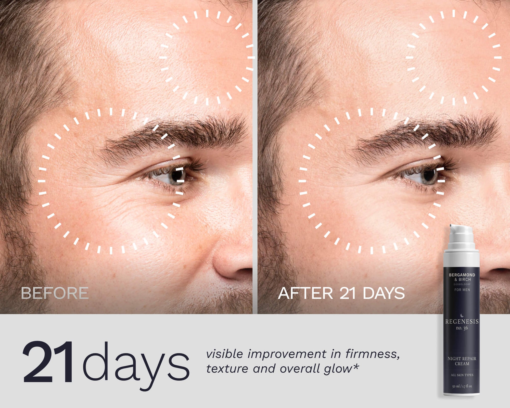 Close-up male face before and after 21 days of Bergamond & Birch Regenesis No. 36 Night Repair Cream, showing visibly improved firmness, smoother texture, and enhanced glow.