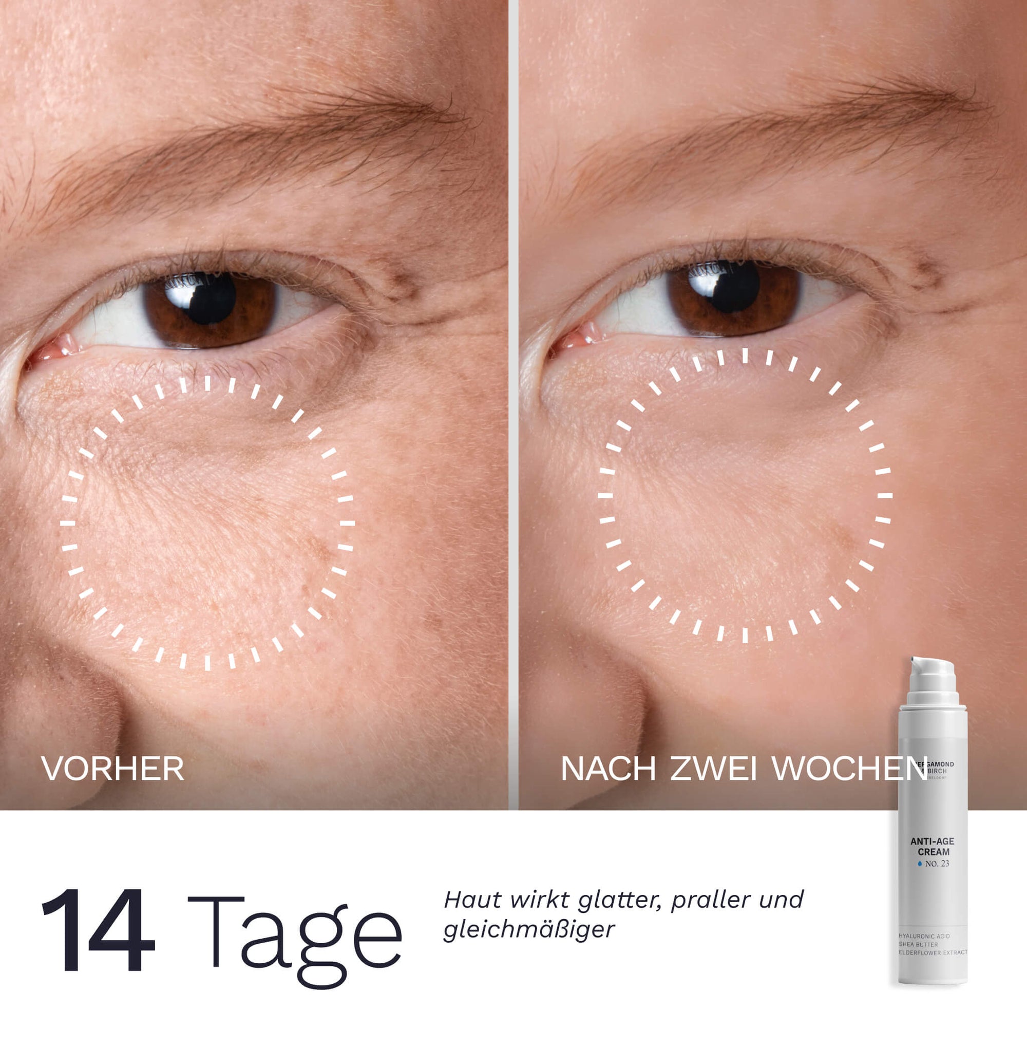 Nahaufnahme der Augenpartie im Vorher Nachher Vergleich über 14 Tage nach Anwendung der Anti Age Daycream No 23 von Bergamond & Birch die Haut wirkt glatter praller und gleichmäßiger
