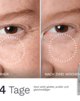 Nahaufnahme der Augenpartie im Vorher Nachher Vergleich über 14 Tage nach Anwendung der Anti Age Daycream No 23 von Bergamond & Birch die Haut wirkt glatter praller und gleichmäßiger
