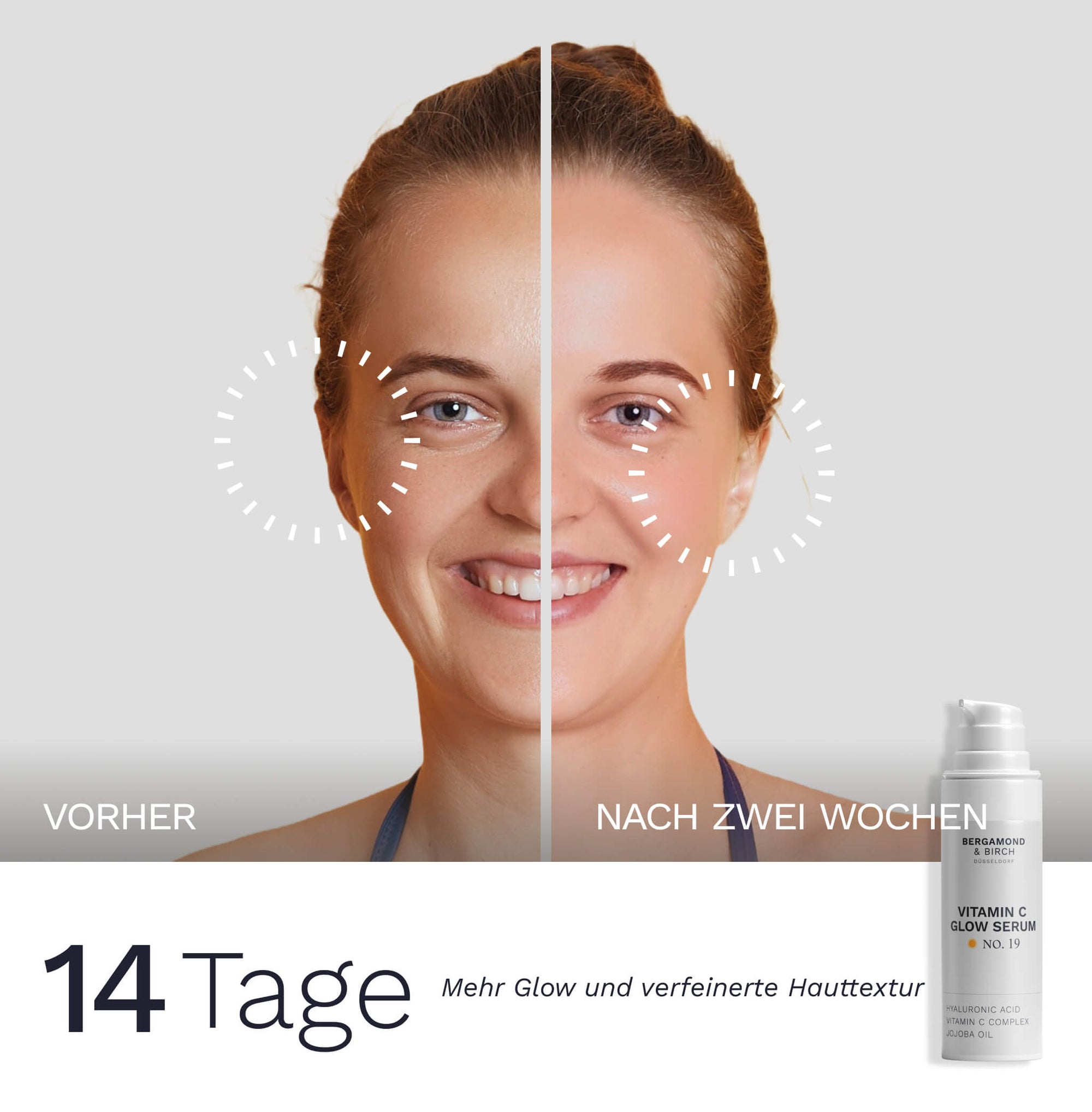 Vorher nachher Vergleich der Gesichtshaut über 14 Tage mit Clarite No 19 Vitamin C Glow Serum von Bergamond & Birch mit dem Hinweis mehr Glow und verfeinerte Hauttextur